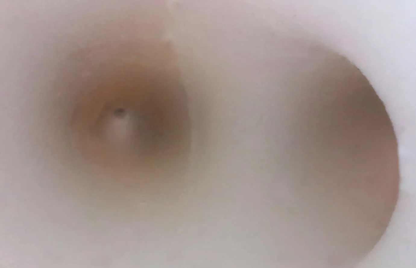 Bronchoscopy training model Fiberoptic Bronchoscopy Exercises Secondary Branch